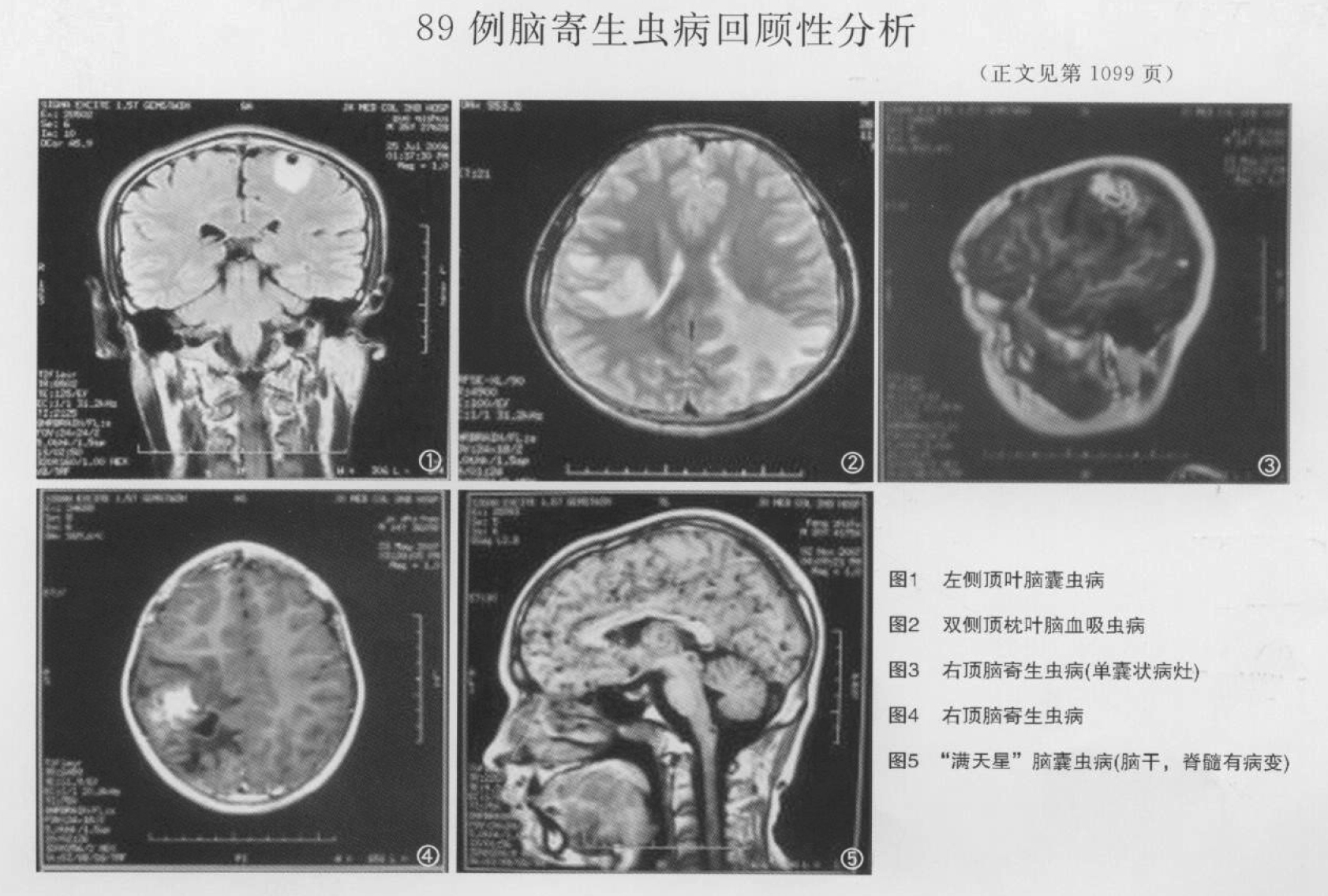 如何检查自己有没有寄生虫病？ - 知乎