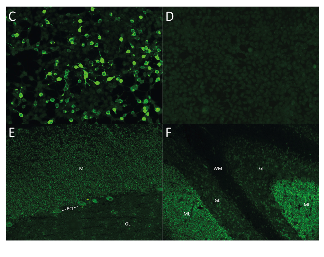 ARHGAP26抗体综述 海默医学