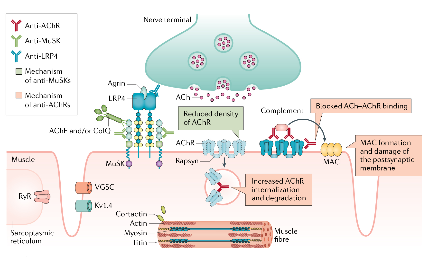 mg的乙酰胆碱受体(acetylcholine receptor,achr)抗体是最常见的致病
