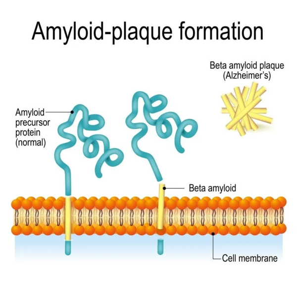 ( amyloid-β,aβ) 是由淀粉样前体蛋白( amyloid precursor protein